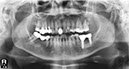 %_tempFileNameImplant%20130c6%