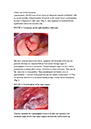 %_tempFileNameA%20New%20Look%20At%20Oral%20Dysplasia%